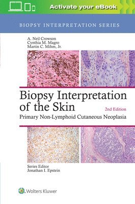 Biopsy Interpretation of the Skin 1