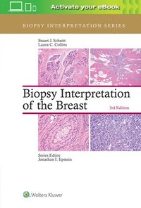bokomslag Biopsy Interpretation of the Breast
