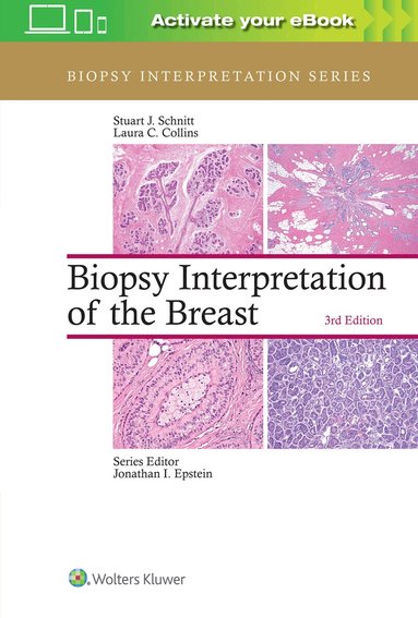 Stuart J. Schnitt, Laura C. Collins - Biopsy Interpretation of the Breast, Inbunden