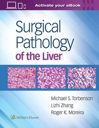 bokomslag Surgical Pathology of the Liver