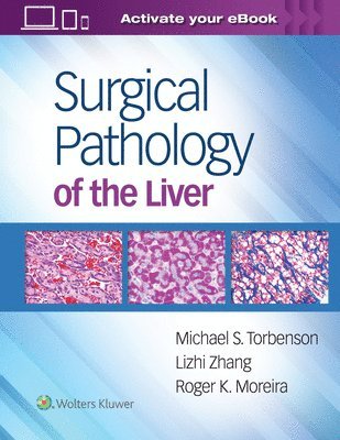 Surgical Pathology of the Liver 1