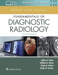 bokomslag Brant and Helms' Fundamentals of Diagnostic Radiology