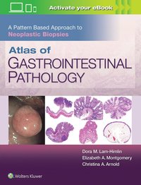 bokomslag Atlas of Gastrointestinal Pathology: A Pattern Based Approach to Neoplastic Biopsies