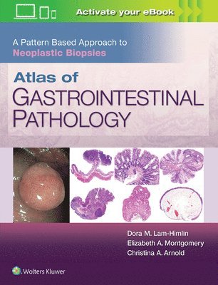 Atlas of Gastrointestinal Pathology: A Pattern Based Approach to Neoplastic Biopsies 1
