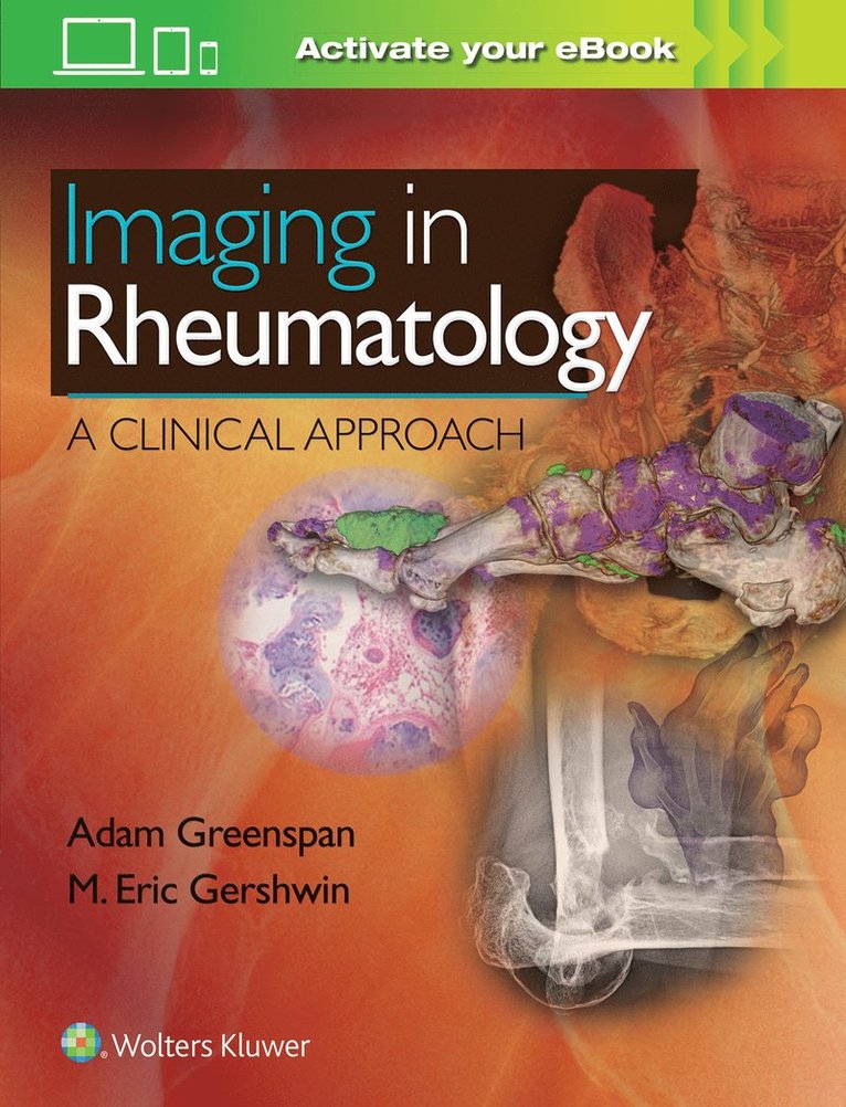 Adam Greenspan, M. Eric Gershwin - Imaging in Rheumatology, Inbunden