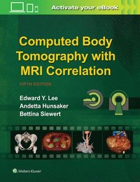bokomslag Computed Body Tomography with MRI Correlation
