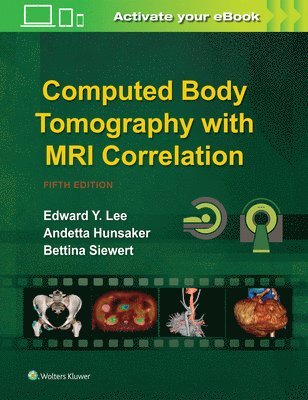 Computed Body Tomography with MRI Correlation 1