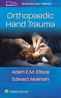 bokomslag Orthopaedic Hand Trauma