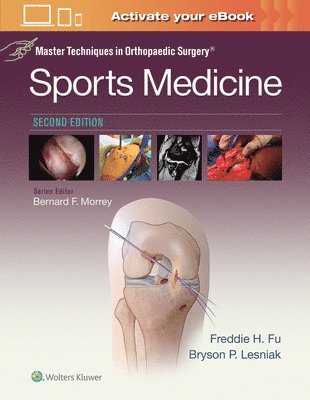 Master Techniques in Orthopaedic Surgery: Sports Medicine 1