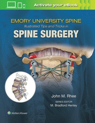 Emory's Illustrated Tips and Tricks in Spine Surgery 1