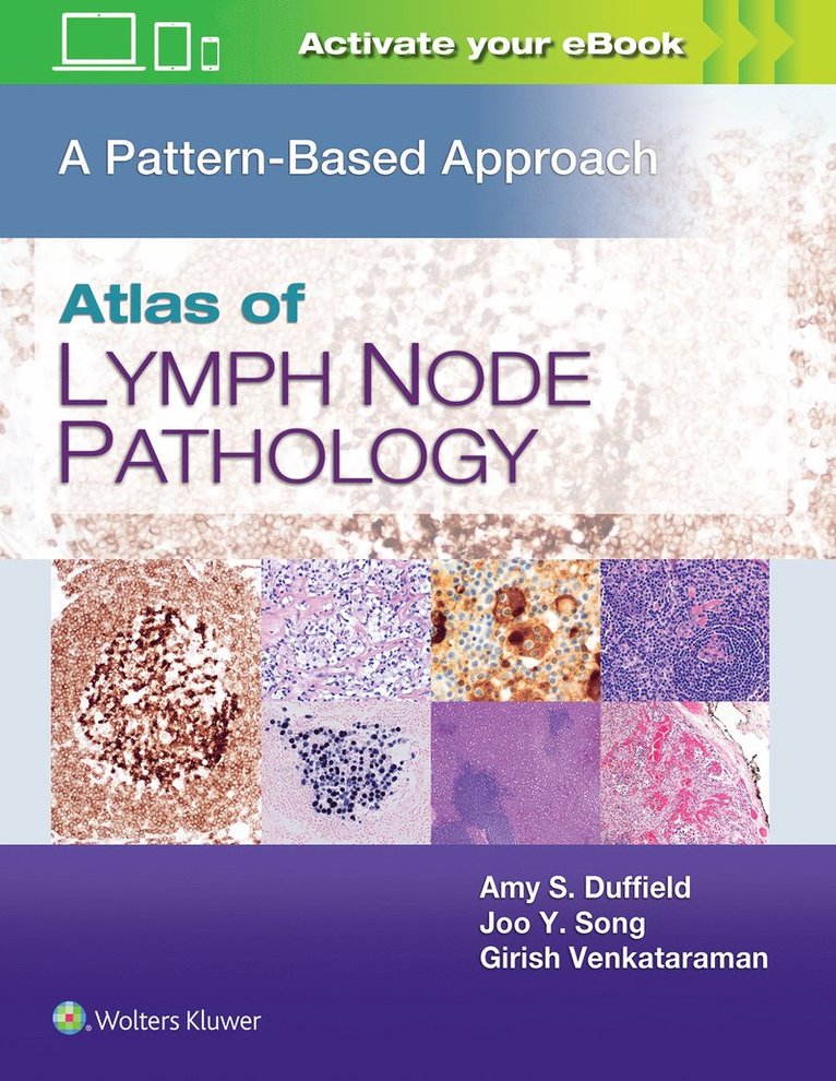 Amy S. Duffield, Joo Y. Song, Girish Venkataraman, MD Duffield, Amy S., MD Song, Joo Y., MD Venkataraman, Girish - Atlas of Lymph Node Pathology, Inbunden