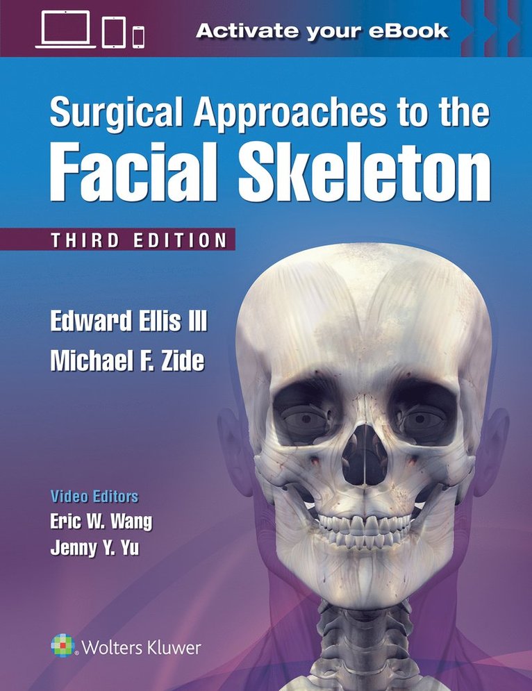 Surgical Approaches to the Facial Skeleton 1