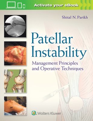 Patellar Instability 1