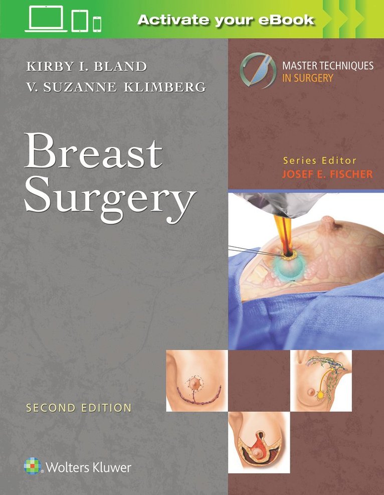 Kirby I. Bland, V. Suzanne Klimberg - Master Techniques in Surgery: Breast Surgery, Inbunden