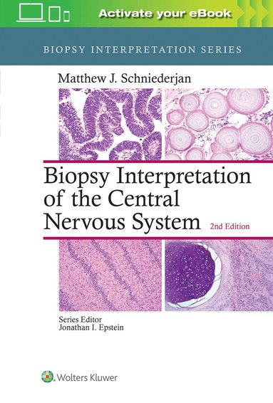 Matthew J. Schniederjan - Biopsy Interpretation of the Central Nervous System, Inbunden