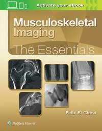 bokomslag Musculoskeletal Imaging: The Essentials