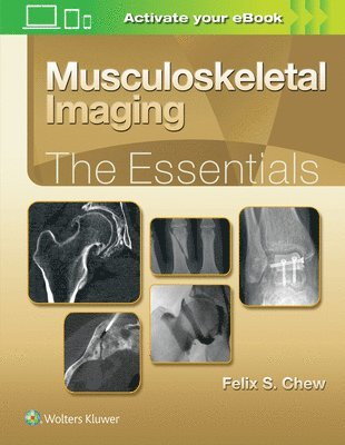 Musculoskeletal Imaging: The Essentials 1