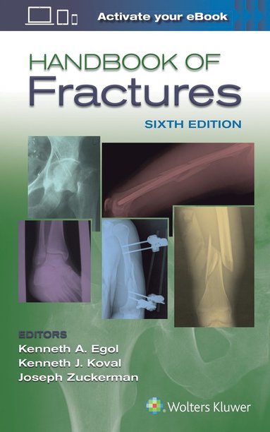 bokomslag Handbook of Fractures