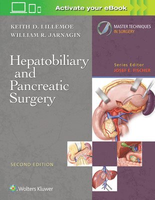 Keith D. Lillemoe - Master Techniques in Surgery: Hepatobiliary and Pancreatic Surgery, Inbunden