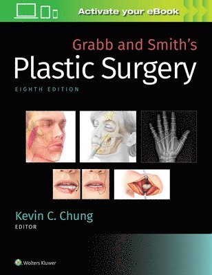 Grabb and Smith's Plastic Surgery 1