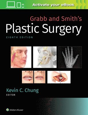 Kevin C. Chung - Grabb and Smith's Plastic Surgery, Inbunden