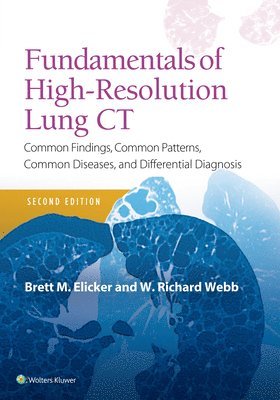 bokomslag Fundamentals of High-Resolution Lung CT
