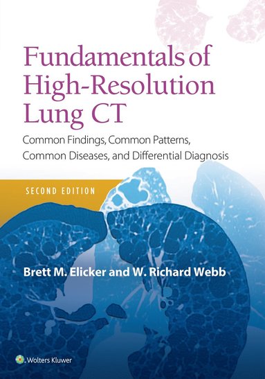 bokomslag Fundamentals of High-Resolution Lung CT