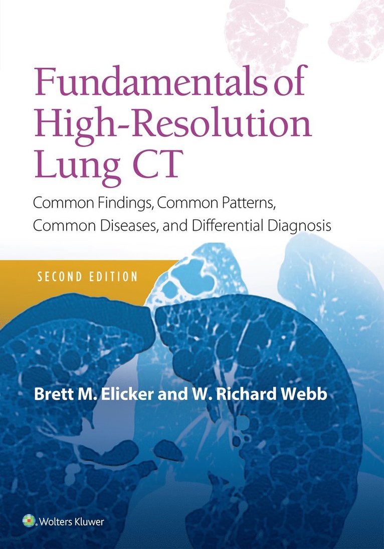 Fundamentals of High-Resolution Lung CT 1