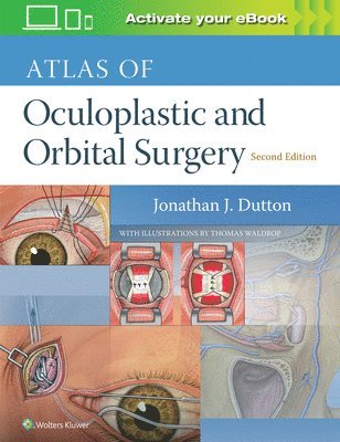 bokomslag Atlas of Oculoplastic and Orbital Surgery