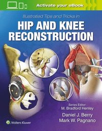 bokomslag Illustrated Tips and Tricks in Hip and Knee Reconstructive and Replacement Surgery