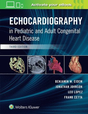 bokomslag Echocardiography in Pediatric and Adult Congenital Heart Disease