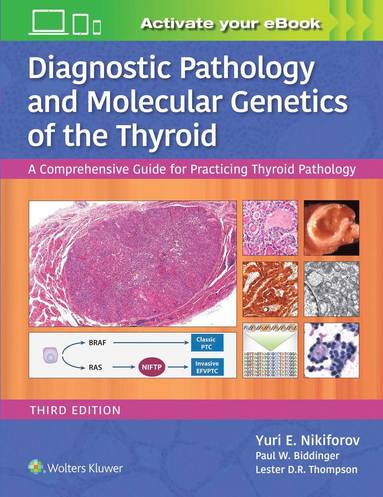 bokomslag Diagnostic Pathology and Molecular Genetics of the Thyroid