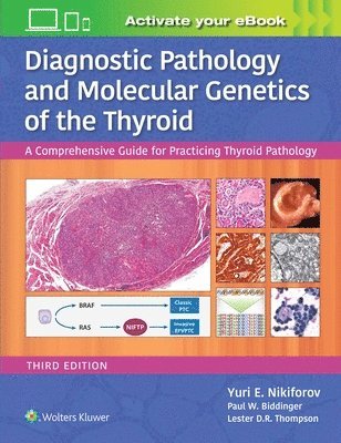 Diagnostic Pathology and Molecular Genetics of the Thyroid 1