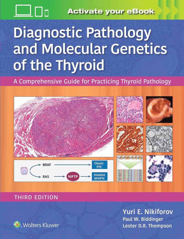 Yuri E. Nikiforov, Paul W. Biddinger, Lester D.R. Thompson - Diagnostic Pathology and Molecular Genetics of the Thyroid, Inbunden