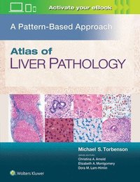 bokomslag Atlas of Liver Pathology: A Pattern-Based Approach