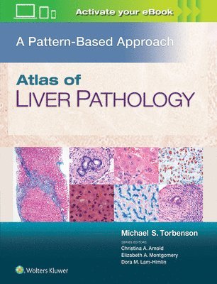 Atlas of Liver Pathology: A Pattern-Based Approach 1