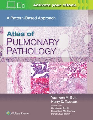 bokomslag Atlas of Pulmonary Pathology