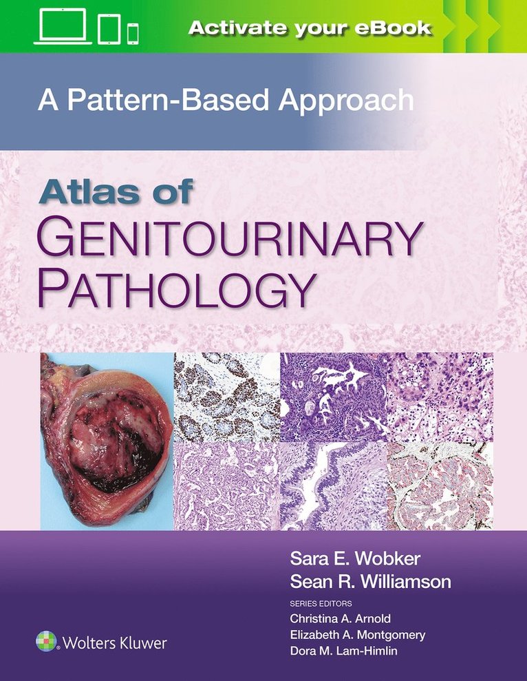 Sara E. Wobker, Sean R. Williamson, MPH Wobker, Sara E., MD, FASCP Williamson, Sean R., MD - Atlas of Genitourinary Pathology, Inbunden