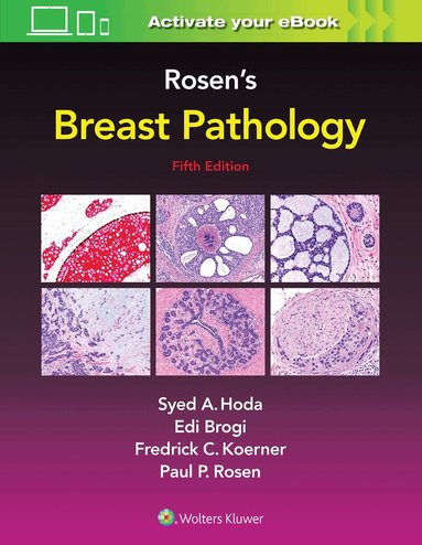 Syed A. Hoda, Paul Peter Rosen, Edi Brogi, Frederick C. Koerner - Rosen's Breast Pathology, Inbunden