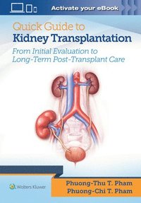 bokomslag Quick Guide to Kidney Transplantation
