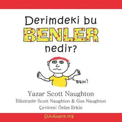 Derimdeki Bu Benler Nedir? 1