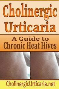 bokomslag Cholinergic Urticaria: A Guide to Chronic Heat Hives