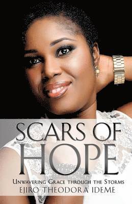 bokomslag Scars of Hope