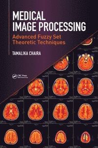 bokomslag Medical Image Processing