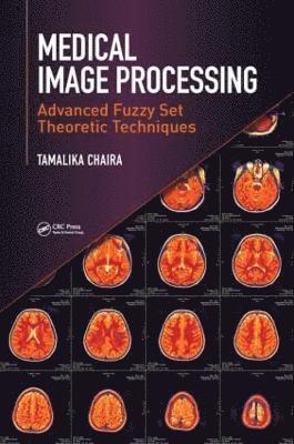 Medical Image Processing