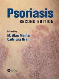 bokomslag Psoriasis