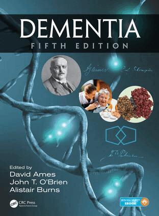 David Ames, John T. O'Brien, Alistair Burns - Dementia, Inbunden