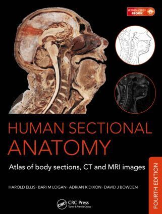 Bari M Logan, Harold Ellis, Adrian K Dixon, David J Bowden - Human Sectional Anatomy, Inbunden