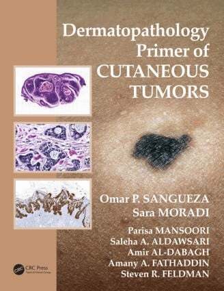 Omar P. Sangueza, Sara Moradi, Parisa Mansoori, Saleha Aldawsari, Amir Al-Dabagh, Amany Abdulgader Fathaddin, Steven R. Feldman - Dermatopathology Primer of Cutaneous Tumors, Häftad