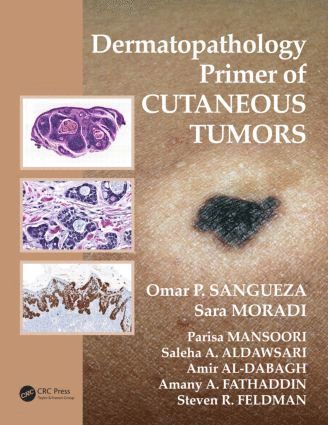 Dermatopathology Primer of Cutaneous Tumors 1